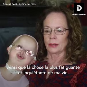 3.6M views · 55K reactions | Cette jeune fille est atteinte du syndrome d'Hallermann-Streiff-François, mais elle ne laisse rien la freiner ! | Demotivateur | Facebook