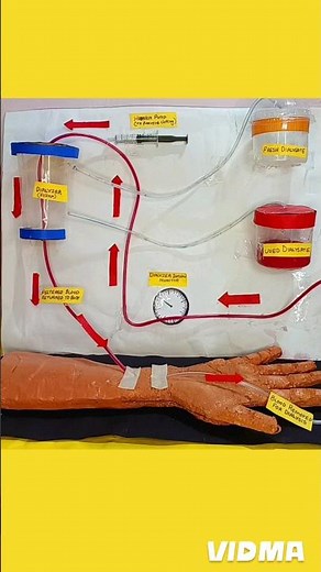 Hemodialysis working model for science project | biology project @SubhamsArtCraftCreations #shorts