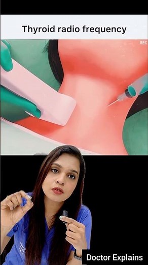 Thyroid Radiofrequency Ablation #drnalliramya #vizagdoctor #vizagent #ent #ramicos #thyroid #rf