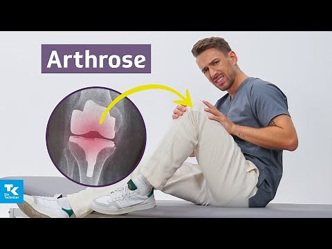 Arthrose verstehen: Ursachen, Symptome, Diagnose & Therapie | DocTommy