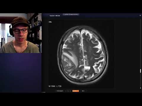 How to use Radiopaedia to teach