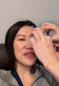 LipiFlow Treatment for Dry Eyes & Meibomian Gland Dysfunction