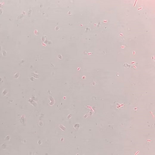 Bacteriophage In Action 10x real time