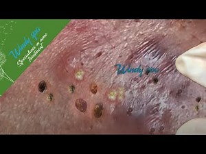 Make Your Day Relaxing with Windy Spa 6#112