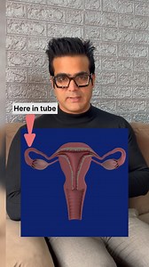 Biochemical pregnancy. . . . . #viral #trending #viralvideos #doctor #gynaecologist #obgyn #kashmir #informative #trendingvideos #pregnancy #couples #married #instareels #instavideos #drirshadahmadwani #usg #test #lab | Dr Irshad Ahmad Wani