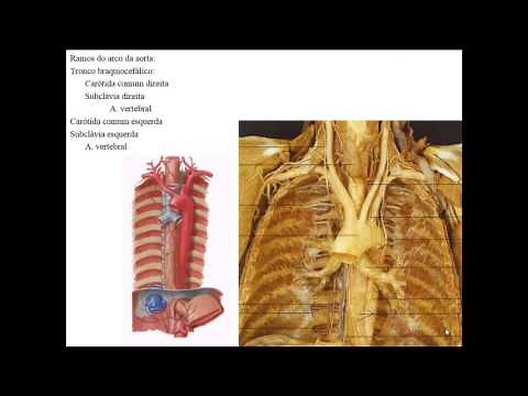 SISTEMA ARTERIAL PARTE 1 - RAMOS DA AORTA ASCENDENTE E ARCO DA AORTA