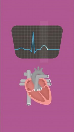 Was ist ein #ekg?