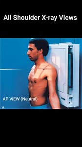 All in one shoulder joint X-ray Views #MRI #radiographer #XRaytechnician #radiographystudent #radiologystudent #medicaltechnologist #xraytechnologist #xray #MedicalTech #orthopaedics #Radiologia #medicaltechnology #radtechstudent #radiologist #Radiography #Radiology #medical #medicalimaging #radiologytechnologist #CTScan #doctor #xraytech #radiologytech #radiologylife #medicalstudent #radtech #shoulders #shoulderpain | Maruf Bhuiyan The Radiographer