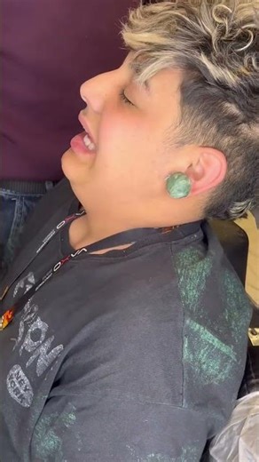 How to treat the biggest ear pimples 😱 #subscribe #barber #viralyoutubeshorts #piercing