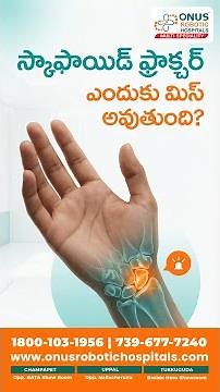 Scaphoid bone fractures are one of the most commonly missed wrist injuries.