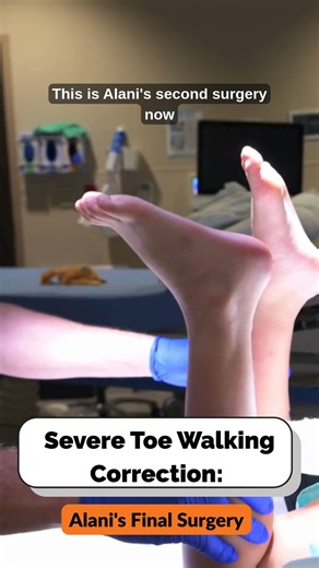 Pediatric Foot & Ankle on Instagram: "Severe toe walking is more than a habit. It can be a serious condition called Gastrocnemius-Soleus Equinus. Watch how Dr. German corrects this issue by performing an Achilles lengthening and removing the low-lying soleus muscle. This final surgery means our patient, Alani, can now run, play, and walk normal—putting pain and social worries behind her! If your child is struggling with toe walking, contact us for a consultation. #ToeWalkingCorrection #Pediatric