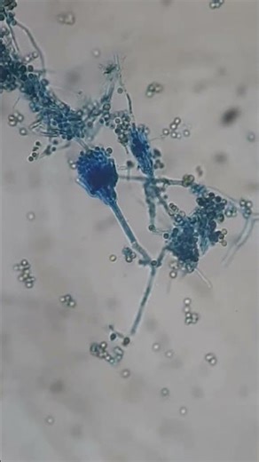 Penicillium structures -Spores, phialides, conidiophores, and mycelium #shorts