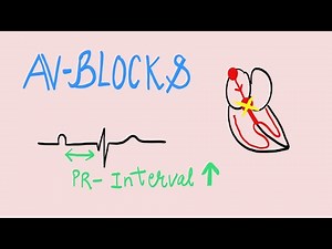 AV Block (Atrio-ventricular block) - Basics of ECG