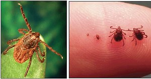 New tick causes epidemic of Rocky Mountain spotted fever