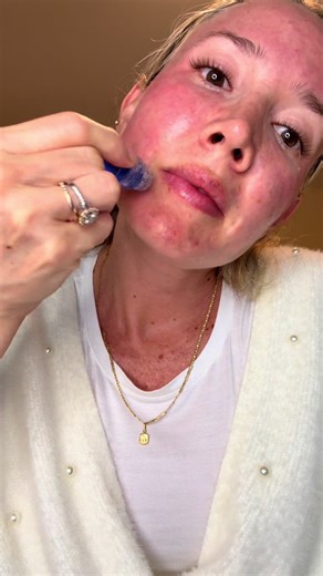 Transforma tu piel en casa con microinfusión