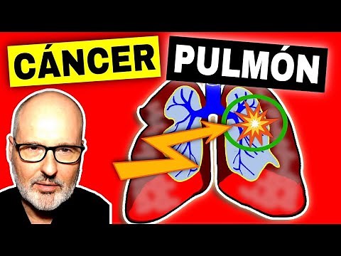 DANGEROUS SYMPTOMS of LUNG CANCER (Causes, Treatment and Prevention)