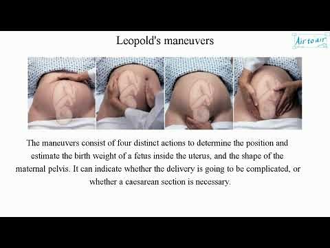 Leopold's maneuvers