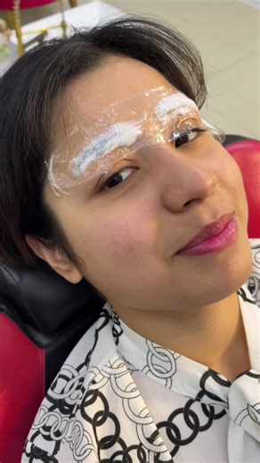 Eyebrow Micro Needling: Transformative Before and After
