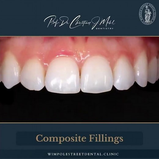 Composite Fillings for Chipped Front Teeth | Before and After