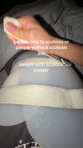 UPDATE‼️NEW TIKTOK ANSWERING MOST FREQUENT QUESTIONS scolihub ask away | SCOLIOSIS AWARENESS #scoliosis #awareness #fyp #viral #questions