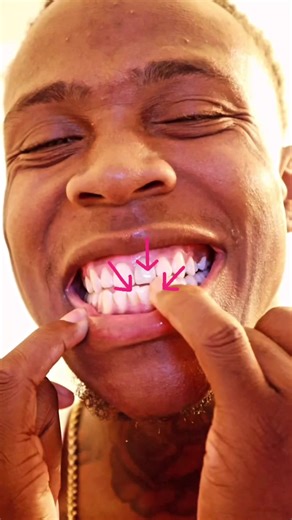 Get Your Impression Kit with BYTE for Only $25