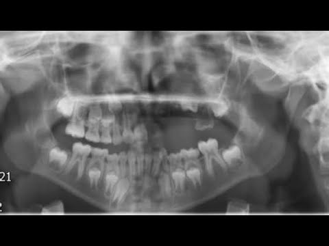 Barely Gentle Dental IRL