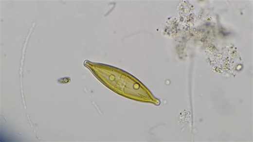 Understanding Diatoms: Their Role in Aquatic Ecosystems | Turab Uddin posted on the topic | LinkedIn