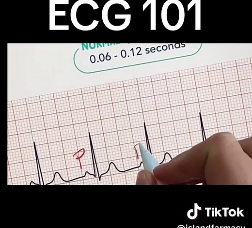Understanding ECG Components: P Wave, PR Interval, QRs Complex