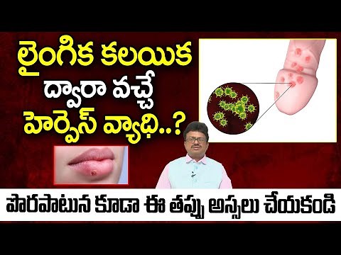 Herpes Simplex Virus | Types, Symptoms And Causes | Treatment And Prevention | Dr. Vellanki Srinivas