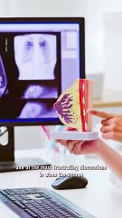 How AI could change breast cancer outcomes