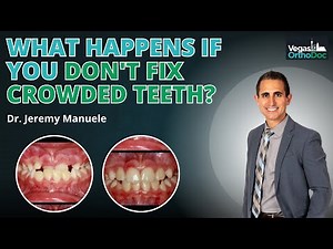 The Hidden Dangers of Untreated Dental Crowding