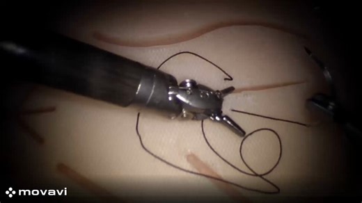 RT @JHUCompSci: #JHUDesignDay26 is just around the corner! Head over to the Rec Center to see the autonomous wound closure system developed…