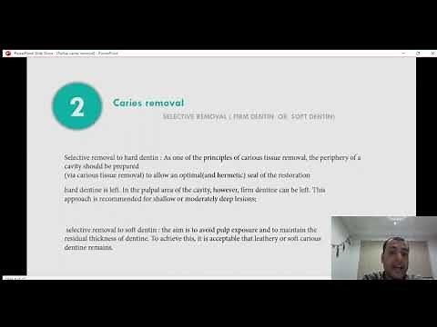 caries removal concepts and techniques