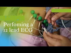 PERFORMING A 12 LEAD ELECTROCARDIOGRAM (ECG)