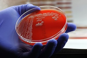 MRSA Infections: Causes, Risks, and Legal Options