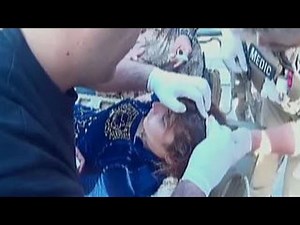 US Marine volunteers as medic in Mosul
