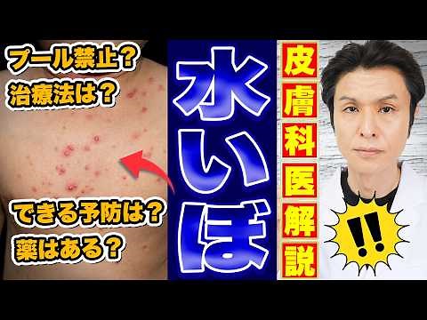 Water warts: A thorough explanation of the causes, infection routes, natural healing, treatments,...