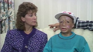 David Rothenberg, whose father set him on fire in 1983, dies at 42