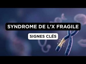 Fragile X Syndrome: A Multidisciplinary Approach