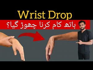 “Wrist Drop (Radial Nerve Palsy) Treatment | 5 Effective Physiotherapy Exercises for Fast Recovery”
