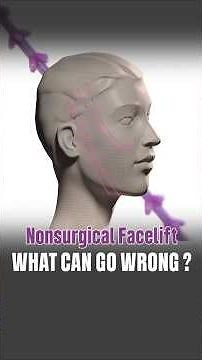 Are Infinite Threads Safe? Non Surgical Facelift Risks, Safety & How Problems Are Managed