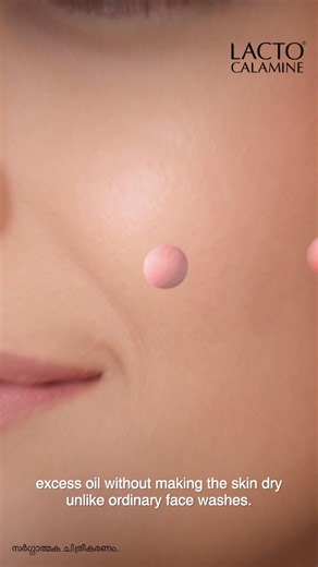 Experience expert care with LactoCalamine and say goodbye to oily skin woes. #OilySkinHaiTohLactoCalamine | Lacto Calamine