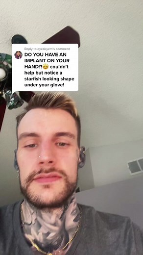 Subdermal Hand Implant Transformation Tutorial