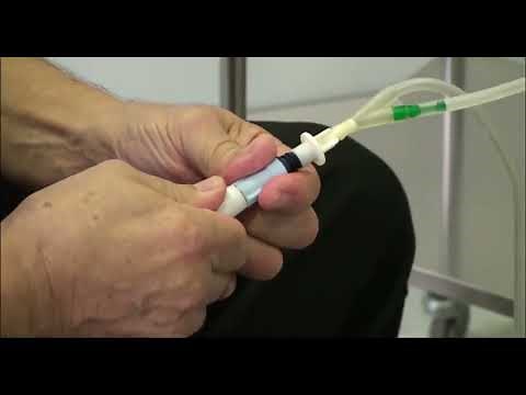 Procedimiento de diálisis peritoneal manual con el sistema Baxter