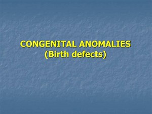 CONGENITAL ANOMALIES (Birth defects) - SlideServe