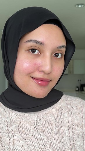 The Power of TCA Cross for Acne Scars | Review