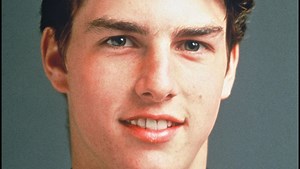 Ces stars avant et après la chirurgie esthétique !