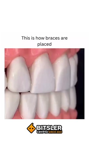 Teach You Biology on Instagram: "The Omnitrix is a powerful and iconic device from the Ben 10 animated series, created by the character Azmuth, an alien scientist of the Galvan species. Originally intended as a way to foster peace and understanding across different alien species, the Omnitrix is a watch-like device that allows its user to transform into various alien beings by reconfiguring their DNA. Each alien transformation offers unique powers and abilities, granting its wearer access to an 