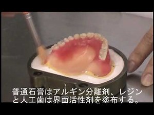 １６ 仮床義歯のフラスコ内石膏埋没－１次埋没