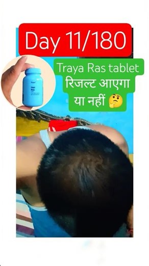 I Tried India's Most Controversial Hair Loss Tablet #traya